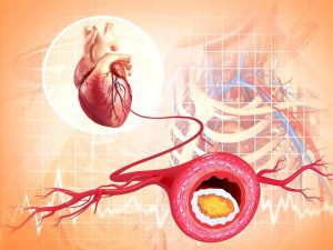 dierlijke vetten en cholesterol