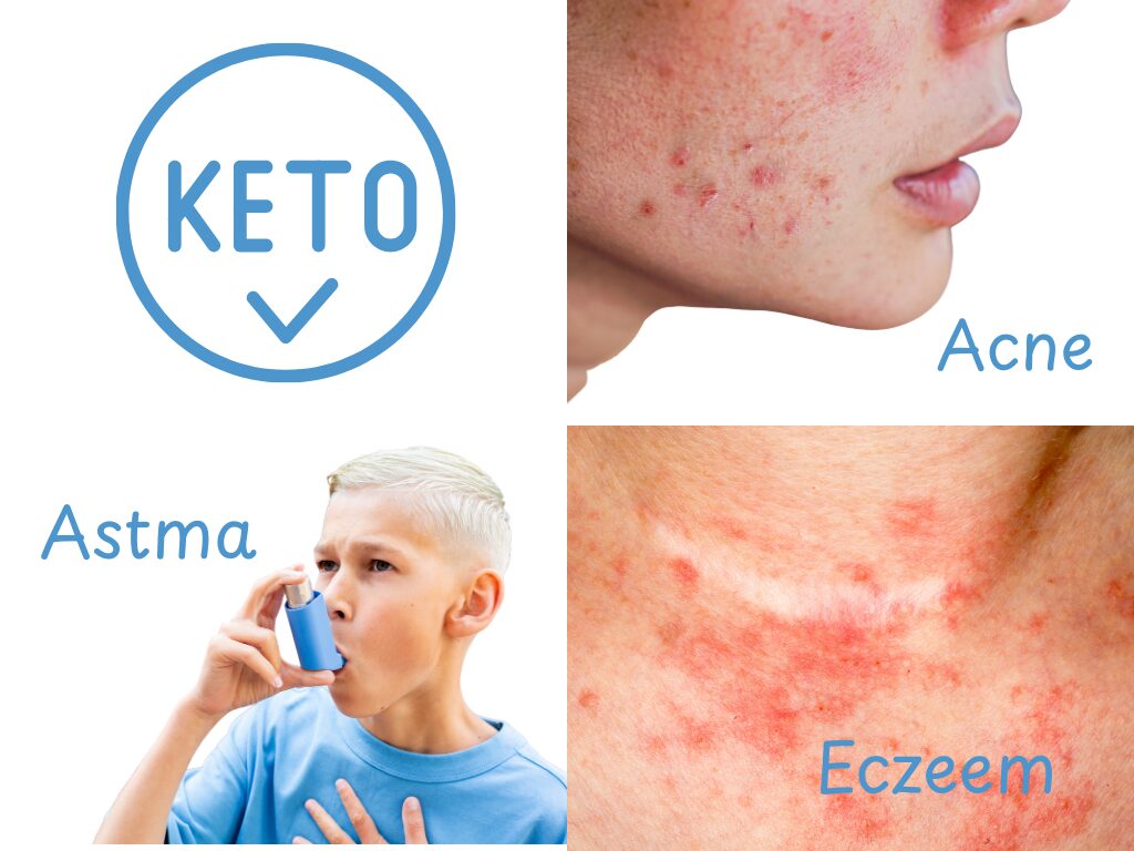 Voeding, astma, acné en eczeem