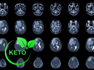 Keto dieet voor neuroblastoma en glioblastoma