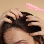 Haaruitval Haaruitval