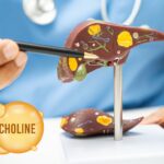 Choline tekort & leververvetting