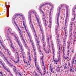 Migrating Motor Complex en je dunne darm